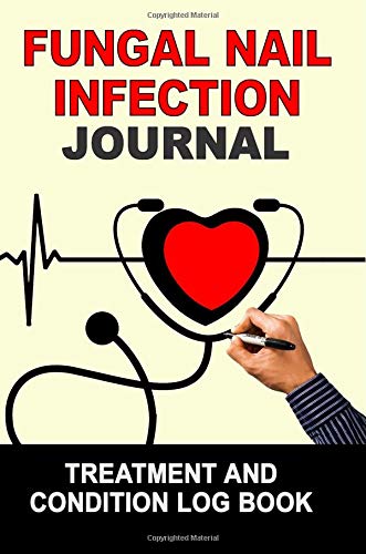 Fungal Nail Infection: Journal Treatment and Condition Log Book